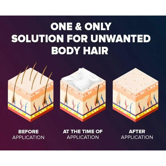 EPIFY - Picture 10 of 15